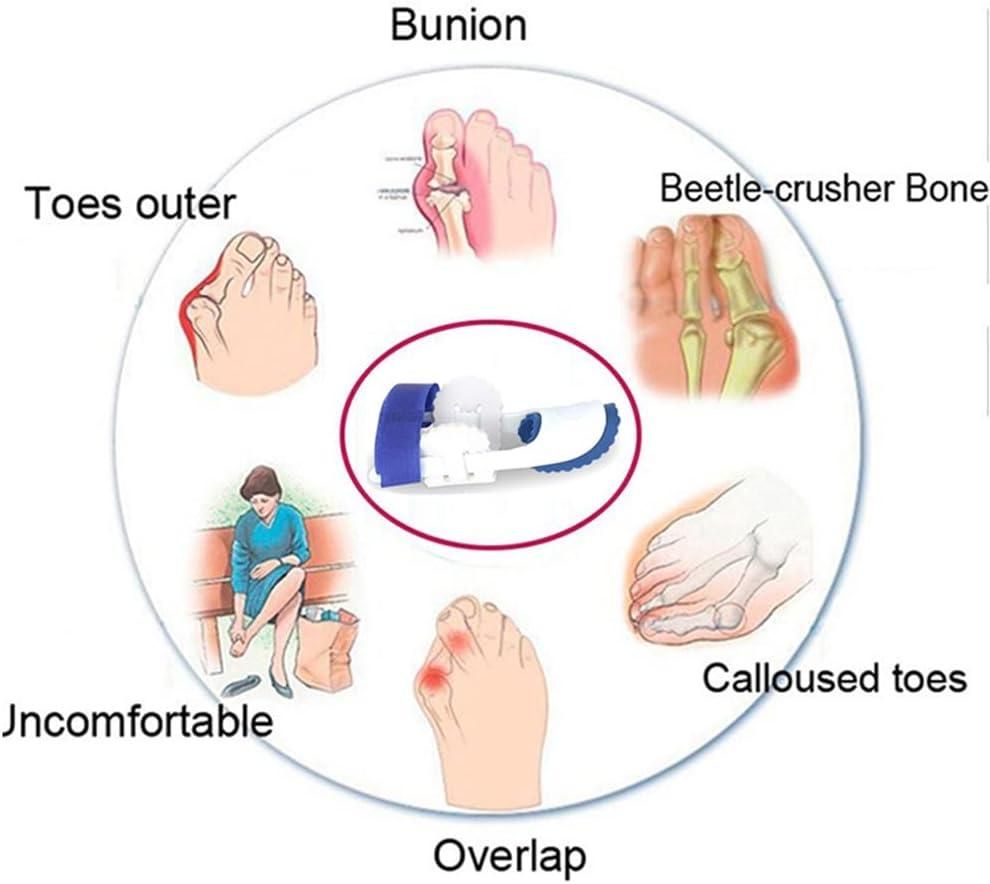 AlignEase™ Bunion Corrector Splint – Orthotic Toe Support (1 Pair)